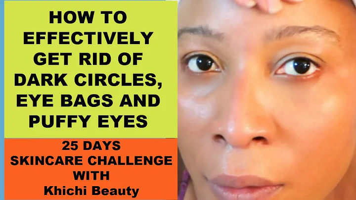 HOW TO EFFECTIVELY GET RID OF DARK CIRCLES, EYE BA...