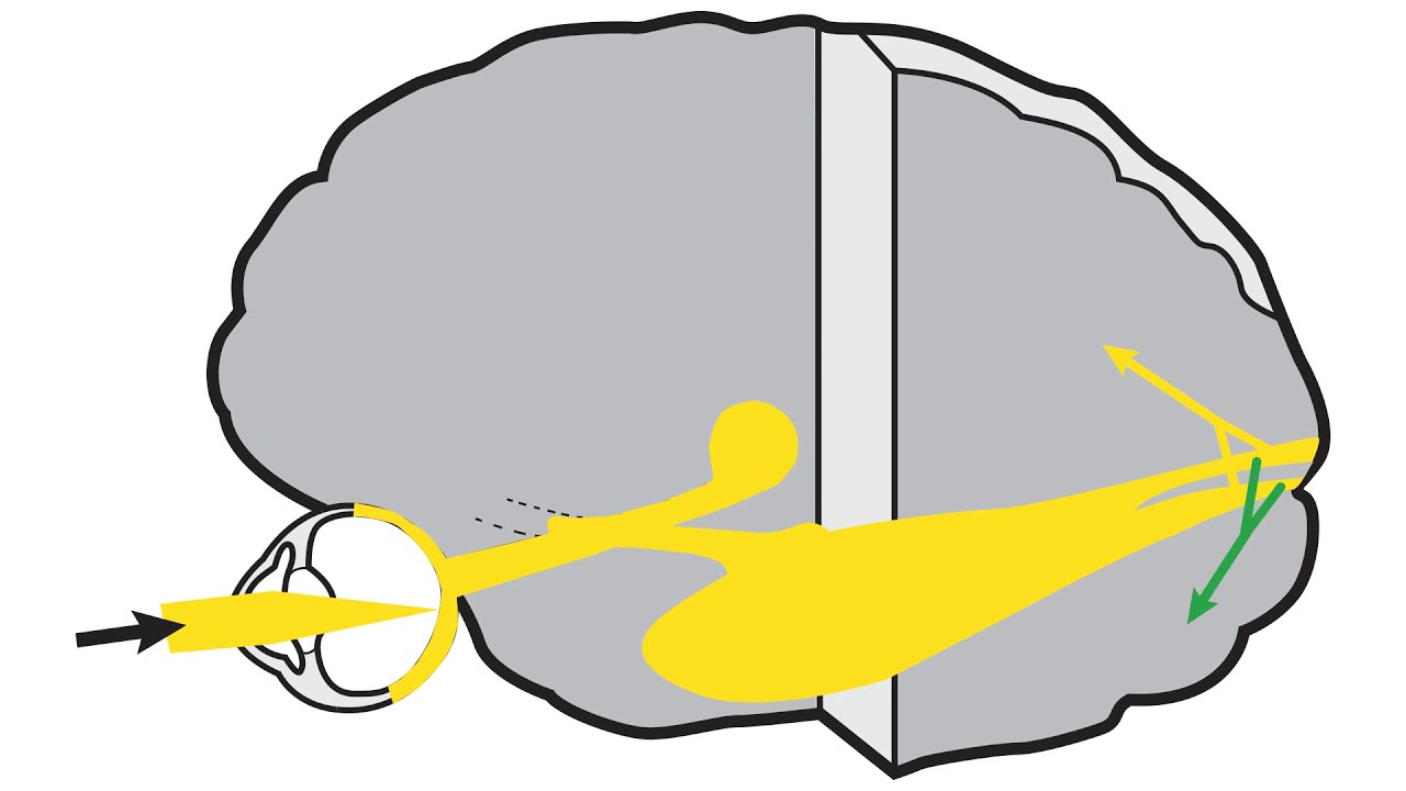 RS Vision Pathway Part 7 - Occipito Temporal Segment