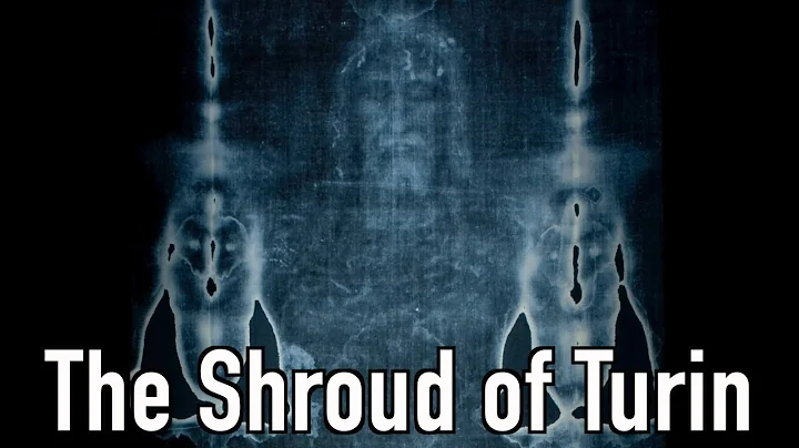The Shroud of Turin: Dr. William Guy and the Case for Authenticity