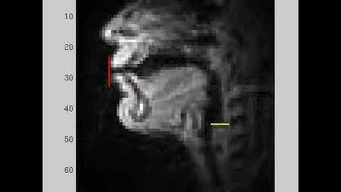 Estimated anatomical landmarks