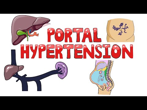 Portal Hypertension - Causes of Portal Hypertension (Pre/Intra/Post Hepatic) | Symptoms & Diagnosis