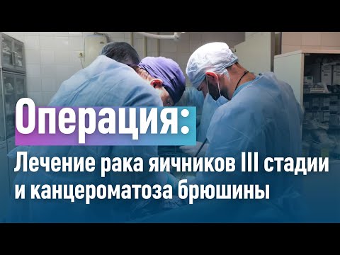 Видео: Как лечить рак яичников: 13 шагов (с иллюстрациями)