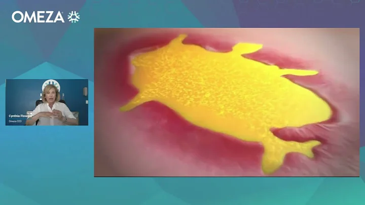 OMEZA Overview