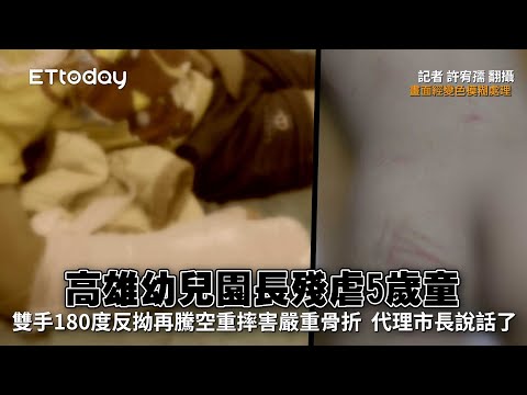 高雄幼兒園長殘虐5歲童！雙手180度反拗再騰空重摔害嚴重骨折　代理市長說話了