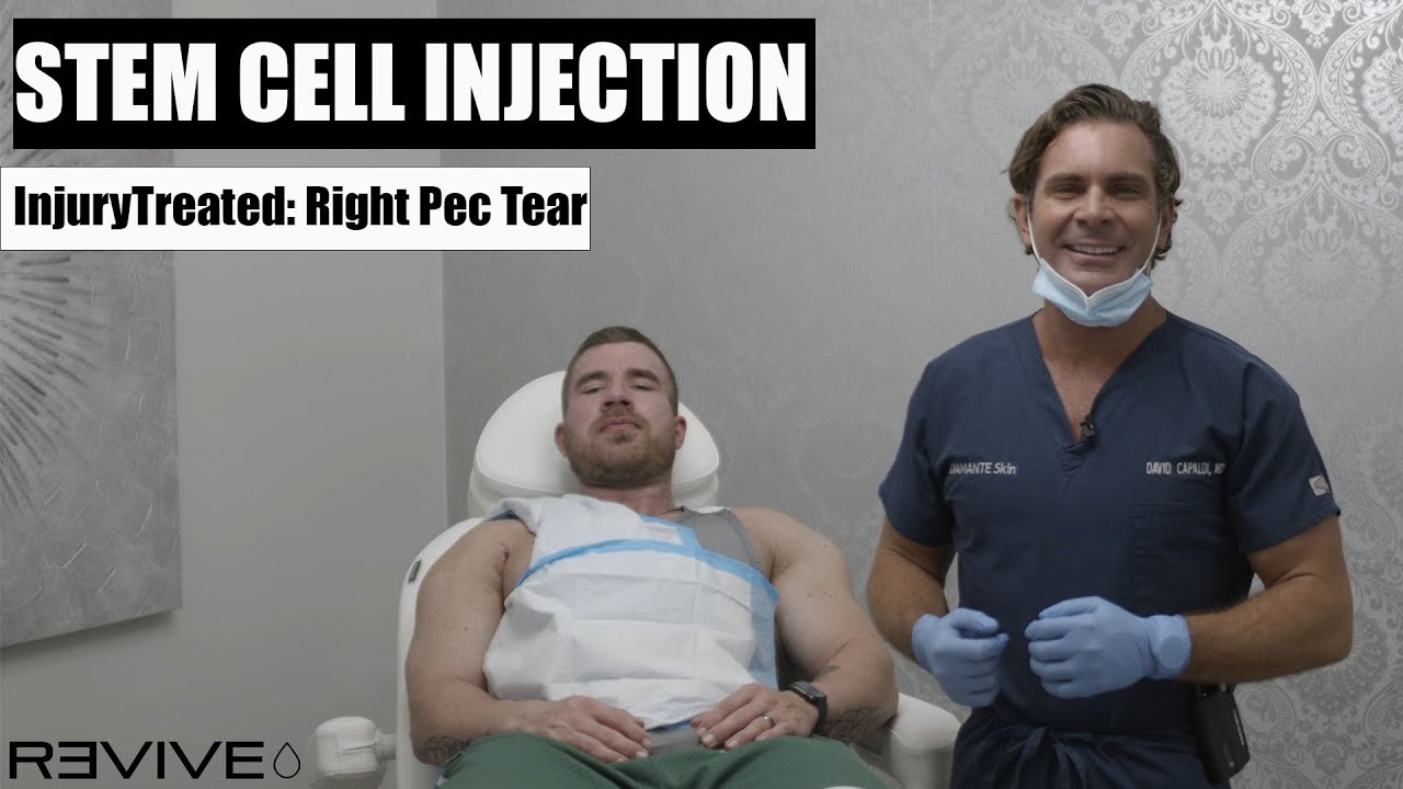 Stem Cell - Matt Jansen Pec Tear Injection (Revive) - YouTube