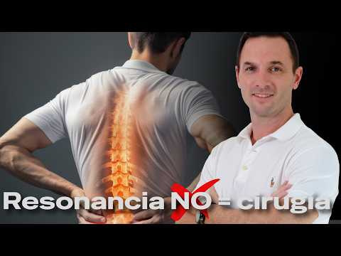 Tu Hernia Discal NO es la causa de tu dolor (La verdad sobre la Resonancia)