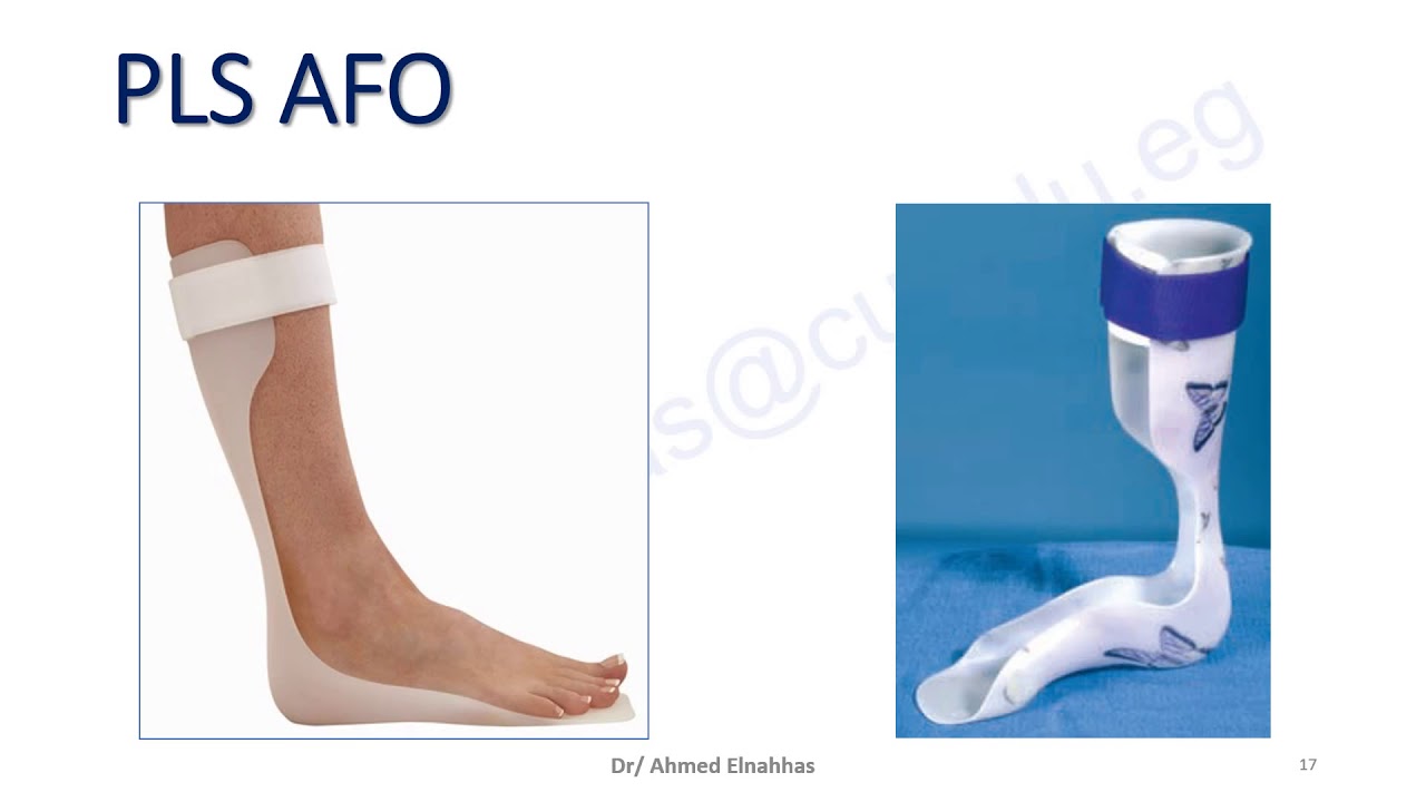 Ankle-foot Orthosis AFO Support Foot Drop Brace | lupon.gov.ph