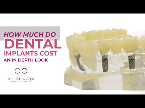 Video: Hoeveel kosten endosteale implantaten?