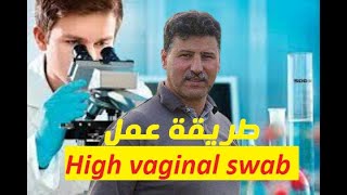 طريقة عمل high vaginal swab test | المسحة المهبلية العلوية | دكتور رمضان ساطي