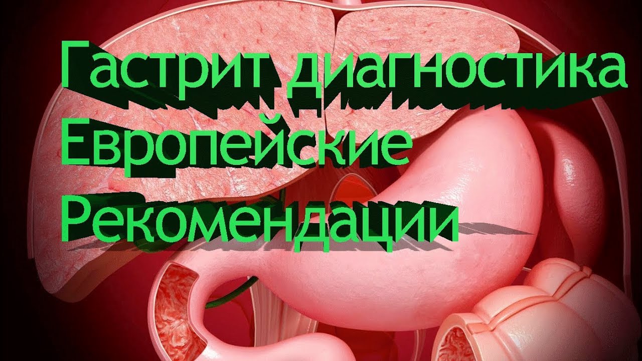 Гастрит диагностика.