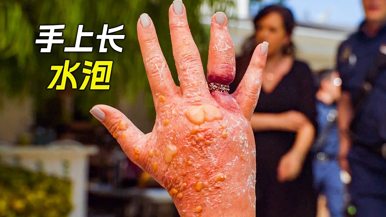女人手上長滿了水泡，只因她偷了一枚戒指，科幻，奇幻，電影，解說，獵奇，懸疑，冒險，短片，short film