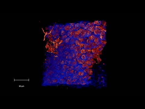 Laser scan of a root showing arbusular mycorrhizal fungi