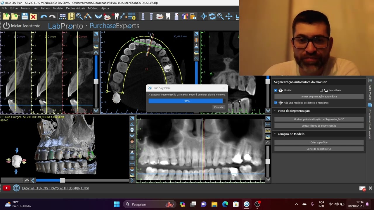 como segmentar tomografias no Blueskybio