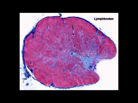 Video: Wo befinden sich die aggregierten Lymphknoten?