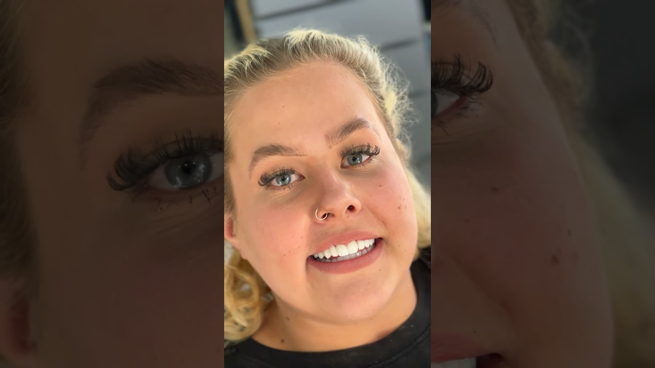 Monarch Smile Turkey — patient video
