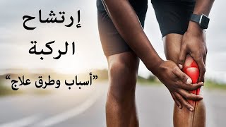 ارتشاح الركبة : أسباب وطرق علاج ارتشاح الركبة