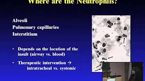 Aging and the Inflammatory Responses After Injury:...