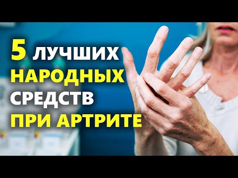 Артрит лечение в домашних условиях