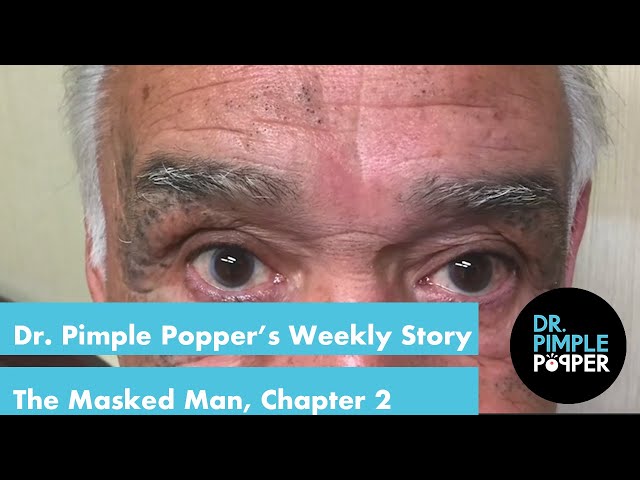 Dr. Pimple Popper's Weekly Story Time: The Masked Man, Chapter 2! class=