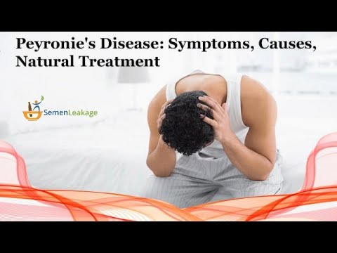 home-remedy-for-peyronie's-disease---best-home-remedy-treatment-for-peyronie's-disease