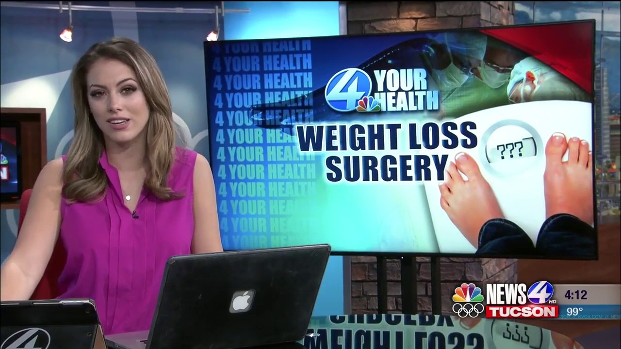 camera iphone 8 plus apk 4 Your Health: Weight-loss surgery health benefits