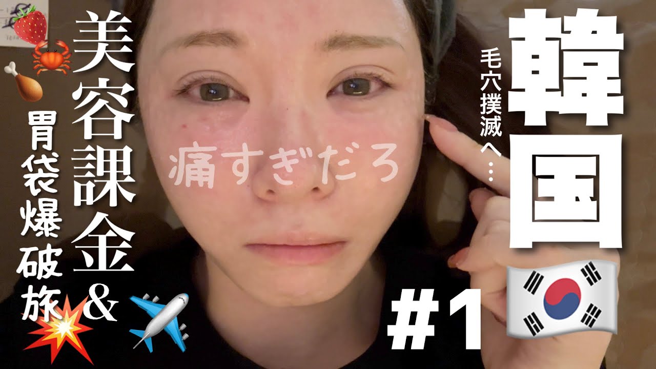 【3泊4日】毛穴地獄アラサーの韓国美容課金&爆食旅Vlog！人気美容施術しに行ったら…#1 シルファーム/ジュベルック/リジュラン