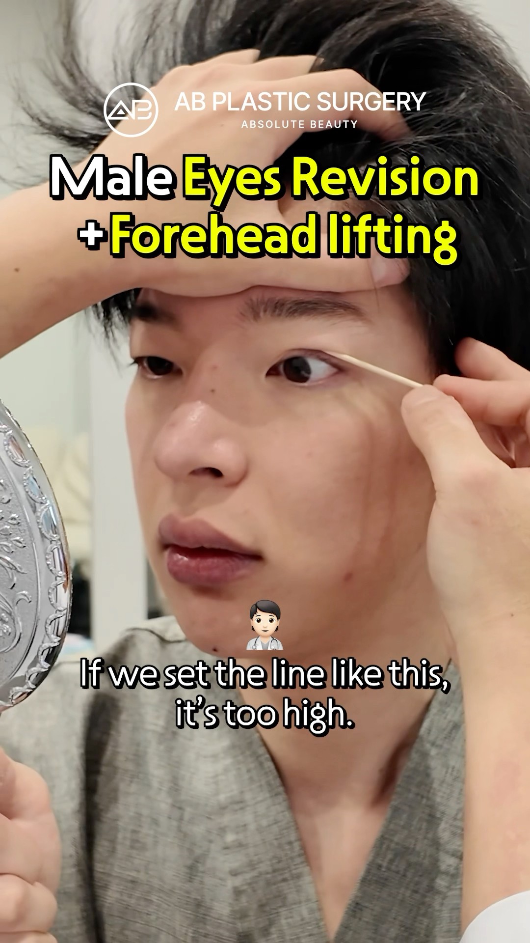 Male Eyelid Fix & Brow Lift #shorts
