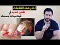 أشيع اعراض نقص الفيتامينات في الجسم  | علاج نقص الفيتامينات طبيعيا #1