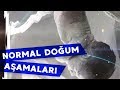 Normal Doğum ve Aşamaları #bebek #anne #çocuk