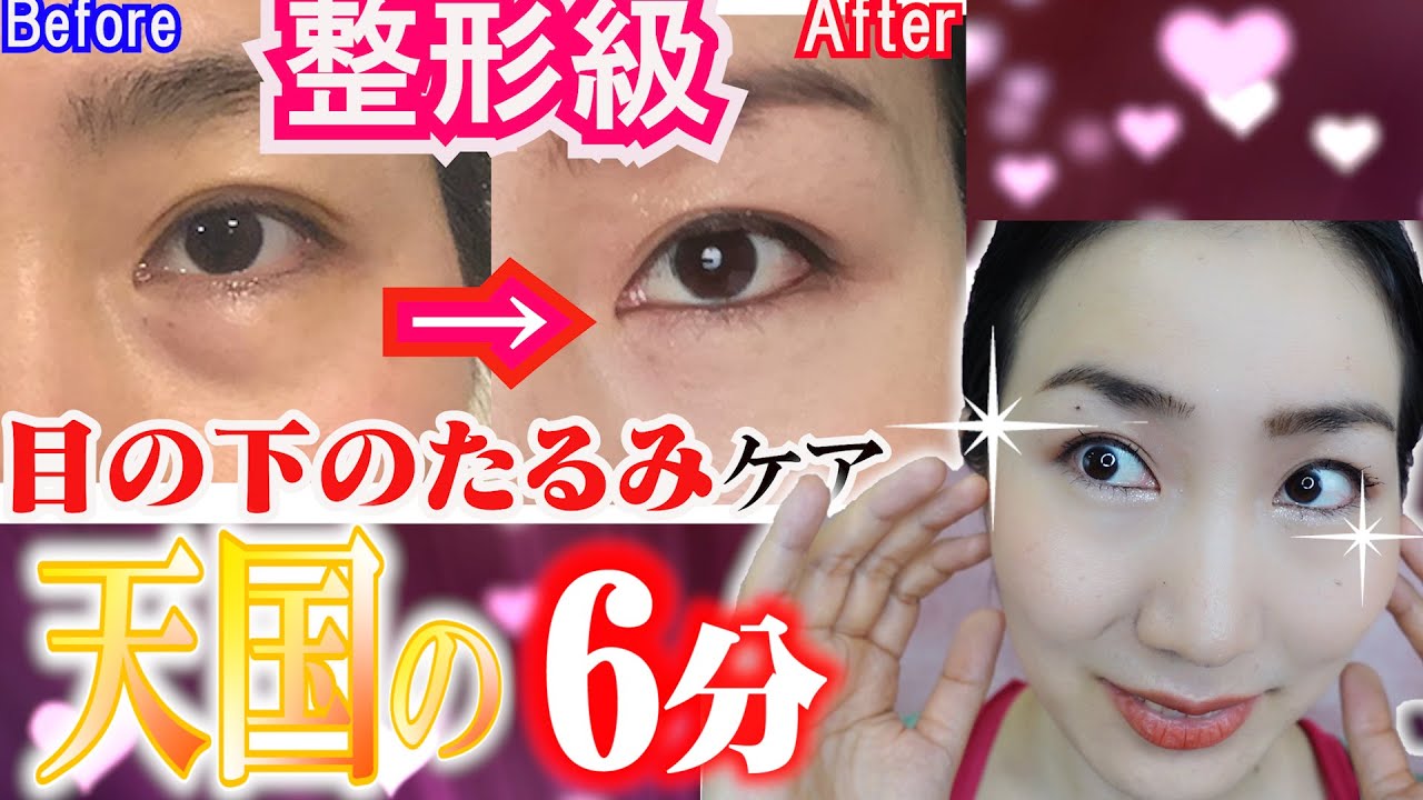 6-Minute Express] Face Yoga Massage & Exercises to Remove Under