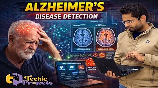 Alzheimer's Disease Detection using CNN | Machine Learning Projects