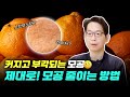 화장품으론 어려운 커진 모공관리  제대로 줄이는 방법! !
