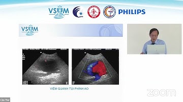 [CME 2022] 11 Siêu âm Doppler và đau bụng cấp nguồn gốc mạch máu - PGS.TS. Nguyễn Phước Bảo Quân