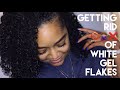 GETTING RID OF GEL FLAKES!!