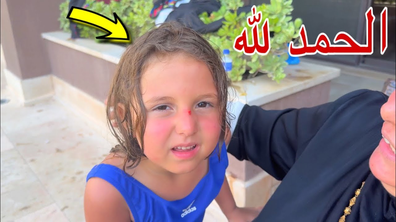 اصابه حياه في حمام سباحة - شوف حصل اية !!