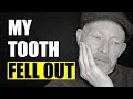 What Did The Carnivore Diet Do To My Teeth?