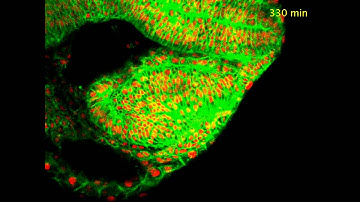 Zebrafish eye morphogenesis