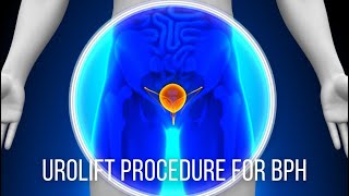 Advanced Urology Institute TV