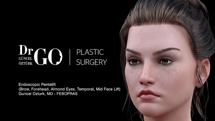 Brow, Forehead, Temporal, Almond Eyes, Mid Face Lift (Endoscopic Pentalift) Assoc.Prof.Guncel Ozturk