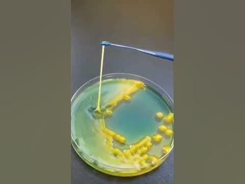 Klebsiella aerogenes - YouTube
