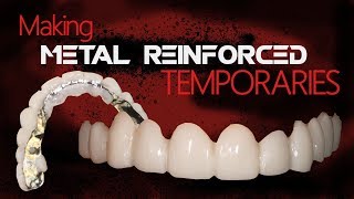 Making Metal Reinforced Temporaries | Dental Lab Techniques