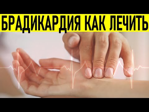 У МЕНЯ БРАДИКАРДИЯ ЧТО ДЕЛАТЬ | Что делать при низком пульсе