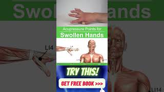 Acupressure Points for Swollen Hands #shorts #acupressure #swollenhands #handswelling #wellness