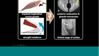 Interpreting Upper Limb Dynamic Simulations in the Context of Clinical Variability