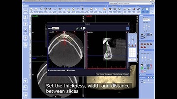 Saving stacks created with 3D Volume Reslicer Tool in Planmeca Romexis® software