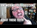 Answering your Questions about These TEETH + More!