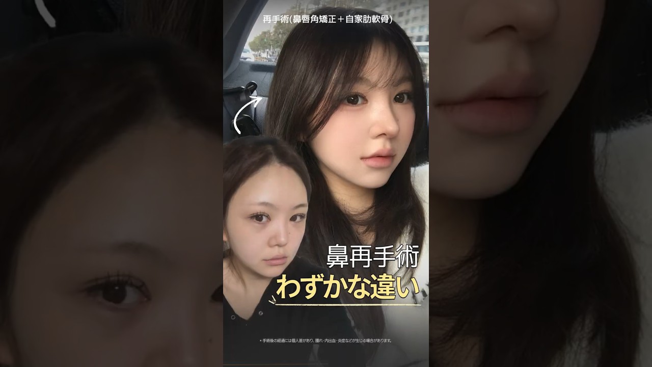 등록한썸네일