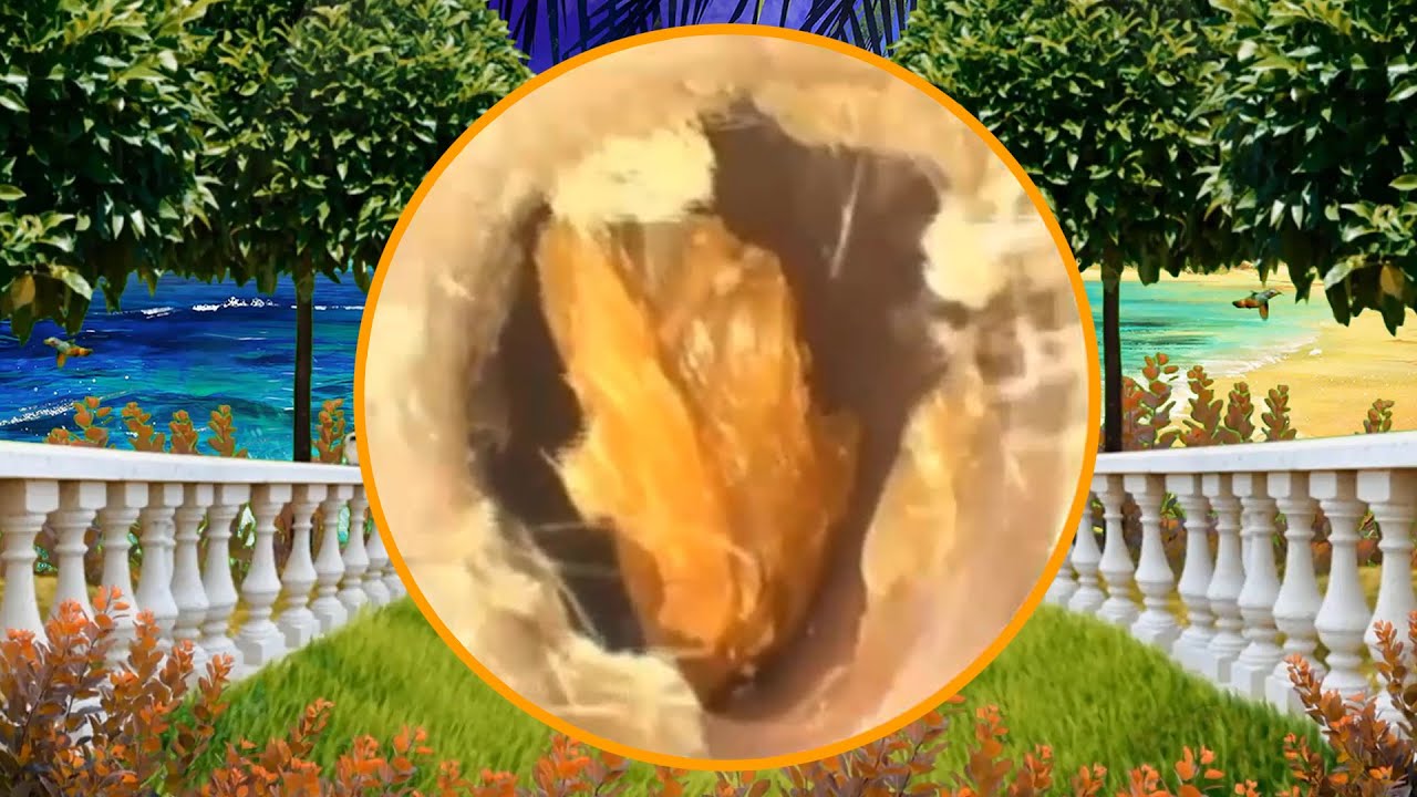 Satisfying Ear Wax Removal With Dr Zhao Video 4 YouTube