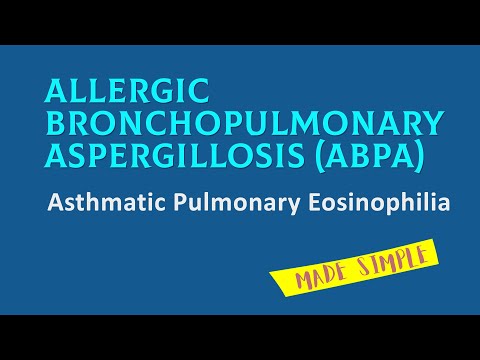 Video: Allergische Bronchopulmonale Aspergillose: Oorzaken En Diagnose