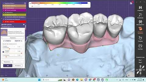 Virtual Gingiva design Exocad 3.1. Easy way to make it. Don